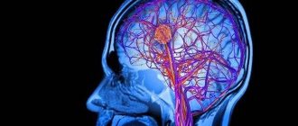 Лакунарный ишемический инсульт головного мозга прогноз