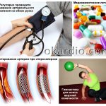 лечение при наличии разницы давления между правой и левой рукой