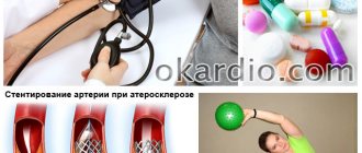 treatment if there is a pressure difference between the right and left hand