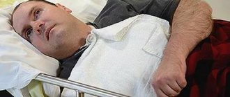лечение стволового инсульта
