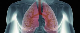 Pulmonary failure