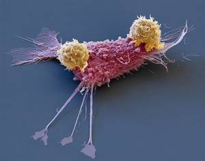 Лимфоциты атакуют раковую клетку