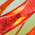 Липопротеин