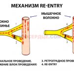 механизм re-entry