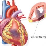 Многим данное понятие незнакомо, другие знают о нем практически все