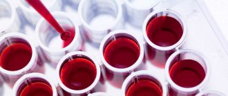 Uric acid in the blood