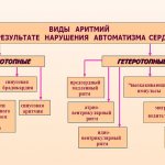 Нарушение автоматизма сердца