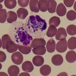 Нейтрофилы атакуют чужеродный белок