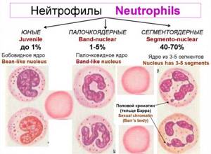 Нейтрофилы понижены у взрослого. Причины лимфоциты завышены, понижены в анализе