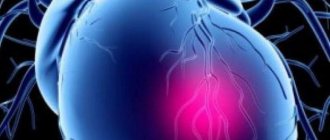 неотложная помощь при кардиогенном шоке