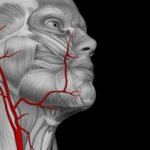 Неполная задняя трифуркация левой внутренней сонной артерии — Про сосуды