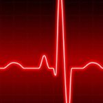 Нерегулярный синусовый ритм