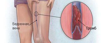 Dangerous disease of the cardiovascular system