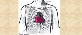Патология контуров сердца при митральной конфигурации, способы диагностики