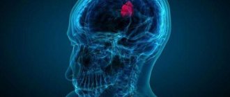 патология мозга