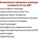 Перечень возможных причин