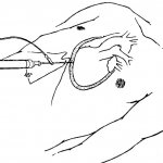 Показания и противопоказания к пункции перикарда
