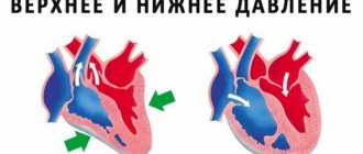 Повышенное систолическое давление при нормальном диастолическом: причины и лечение