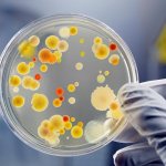 Причины повышенного антистрептолизина О