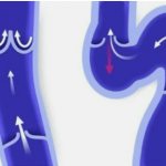 Рефлюкс обозначен красной стрелкой