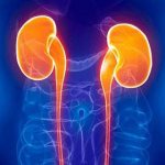 реноваскулярная гипертензия