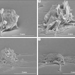 Рис. 5. Сканирующие электронные микрофотографии процесса распластывания активированного тромбоцита по поверхности («Природа» №2, 2014)