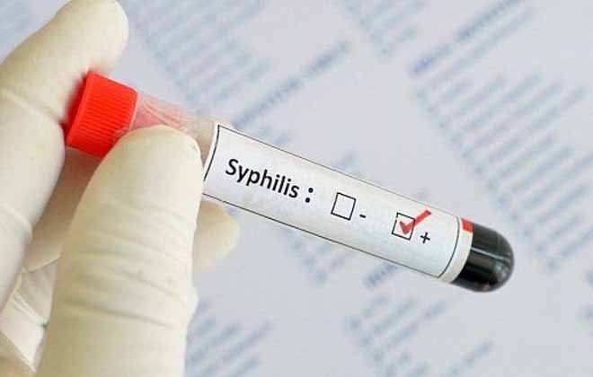Сифилис в крови