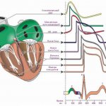 Симптомы и признаки патологий при плохой кардиограмме сердца