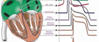 Symptoms and signs of pathologies with a poor cardiac cardiogram