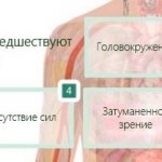 Симптомы, предшествующие обмороку