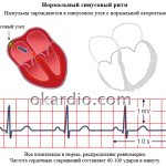 синусовый ритм здорового сердца