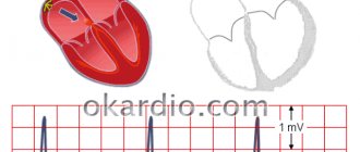 sinus rhythm of a healthy heart