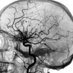 снимок ангиографии