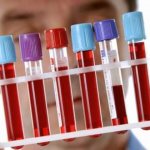 СОЭ по методике Вестергрена, преимущества и выявление заболеваний, причины повышения или снижения данного показателя