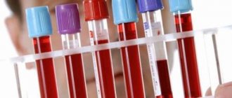 СОЭ по методике Вестергрена, преимущества и выявление заболеваний, причины повышения или снижения данного показателя