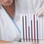 СОЭ при беременности: повышенное, норма, пониженное