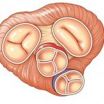 Трикуспидальный клапан