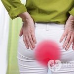 Тромбоз узла при геморрое является серьезным осложнением, которое в отсутствие медицинской помощи может привести к еще более опасным последствиям