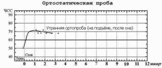 Morning orthostatic heart rate test - measuring pulse in the morning, on the rise (after sleep), in a lying and standing position