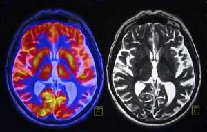 УЗИ сосудов головного мозга и шеи. Как подготовиться, как делают, чем лучше МРТ. Адреса и цены клиник