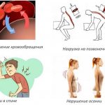 В чем взаимосвязь между ВСД и остеохондрозом позвоночника