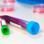 В крови повышены лимфоциты