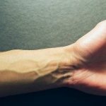 Veins on the arms