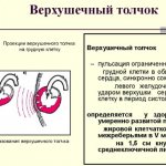 Верхушечный толчок. Норма у детей, при гипертонической болезни, гипертрофии желудочка, ИБС
