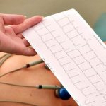 вертикальная эос у ребенка