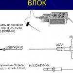 ВЛОК. Показания и противопоказания, что это, для чего нужен, отзывы