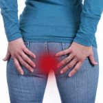 воспаление геморроя