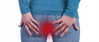 inflammation of hemorrhoids