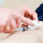 Выполнение внутривенной инъекции