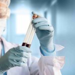 взятие крови из вены